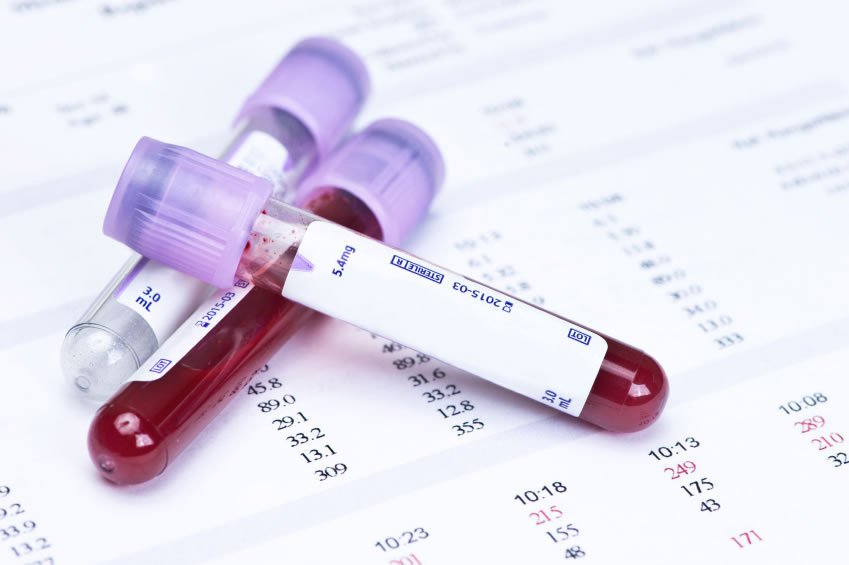 Công thức máu và các chỉ số xét nghiệm máu - DNA Testings
