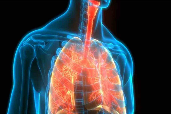 bệnh viêm phổi là gì