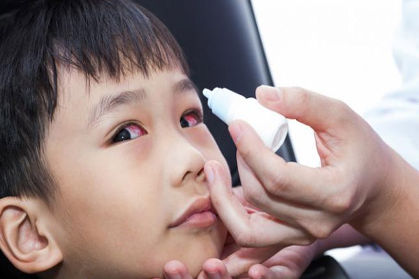 biện pháp phòng bệnh đau mắt đỏ