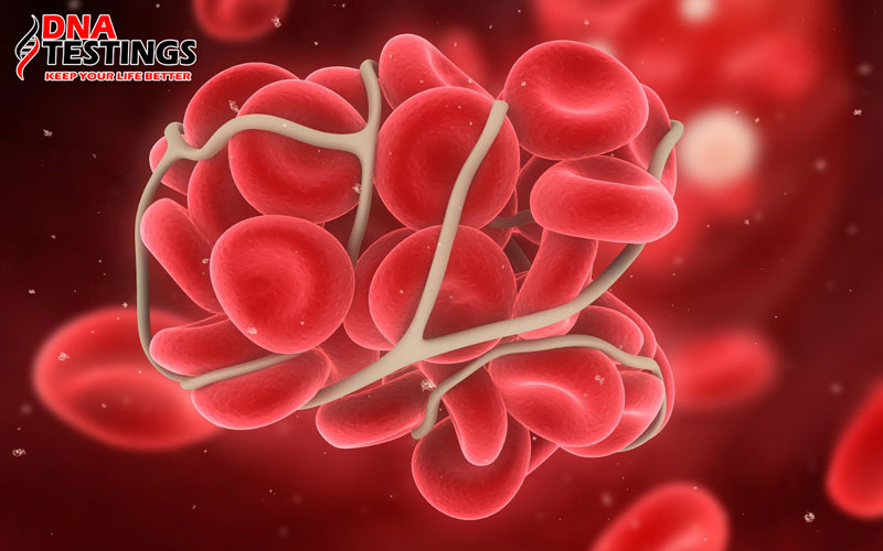 Thrombophilia là gì?