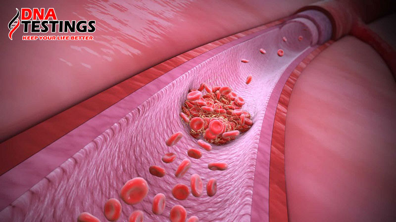 Xét nghiệm Thrombophilia – Hội chứng tăng đông máu ở mẹ bầu