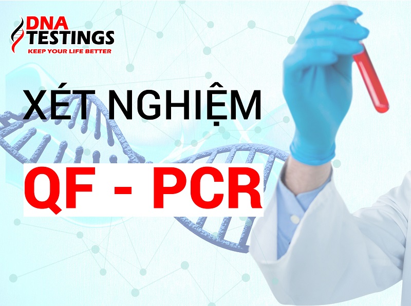 Xét nghiệm QF-PCR trong chẩn đoán trước sinh