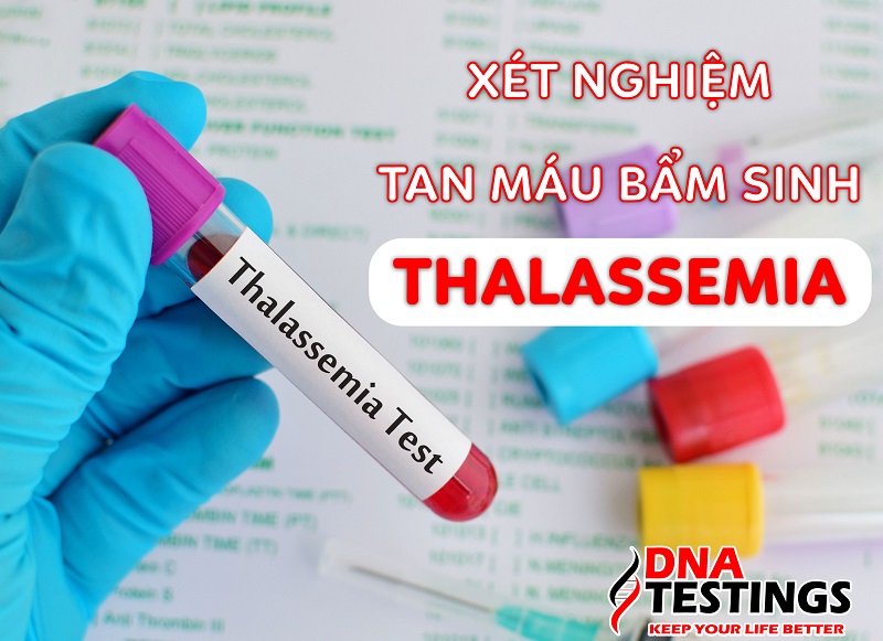 Xét nghiệm Thalassemia hết bao nhiêu tiền? Thực hiện ở đâu?