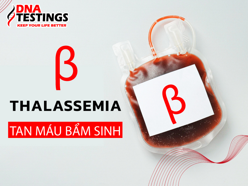 Bệnh beta thalassemia: Nguyên nhân, triệu chứng, cách điều trị