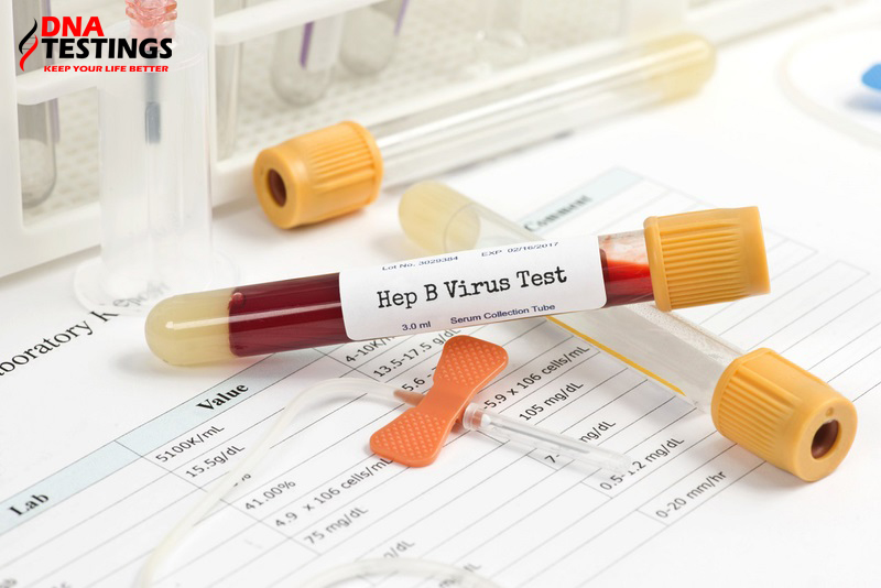 đọc kết quả xét nghiệm đo định lượng virus viêm gan b