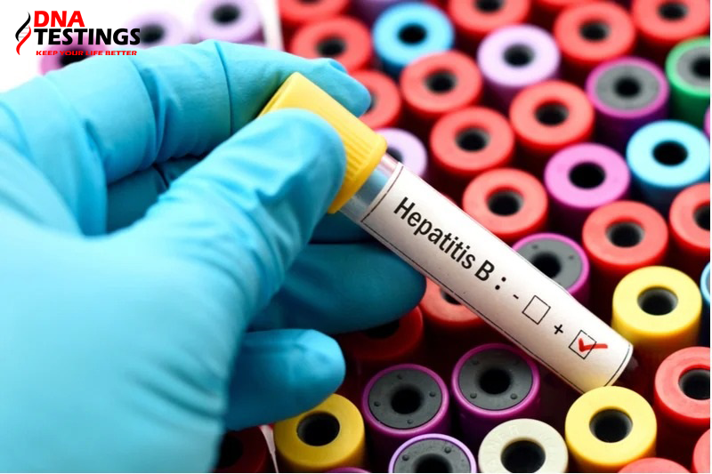 Xét nghiệm định lượng Virus viêm gan B có ý nghĩa gì?