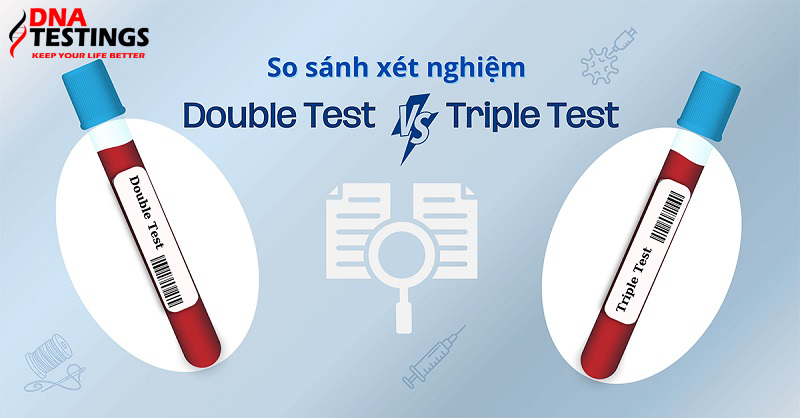 So sánh xét nghiệm Double test và Triple test