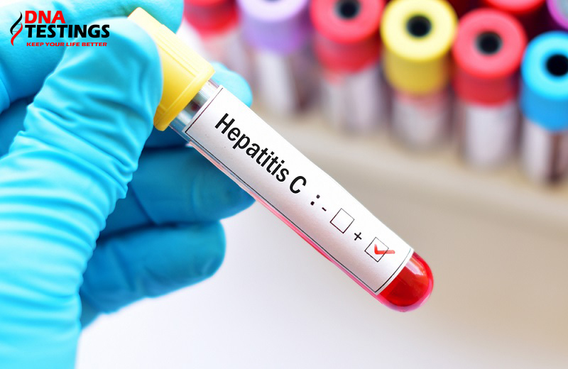 Mục đích, ý nghĩa của xét nghiệm định lượng virus viêm gan C