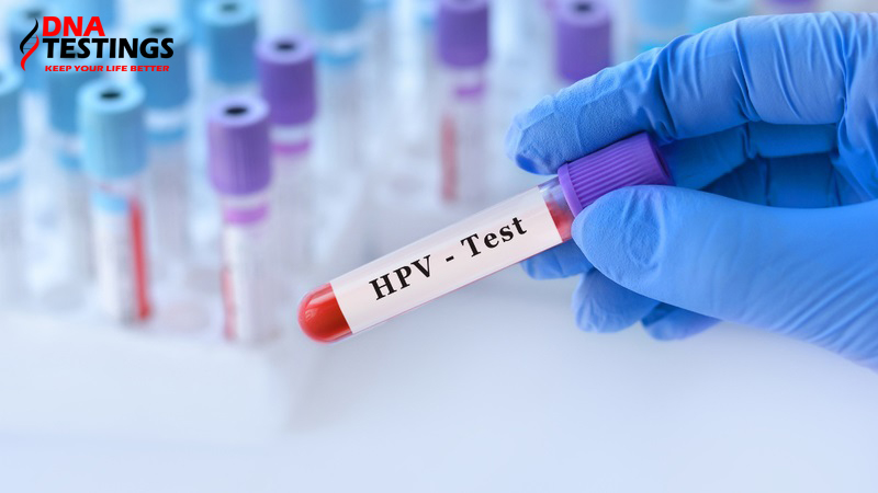 xét nghiệm định type hpv