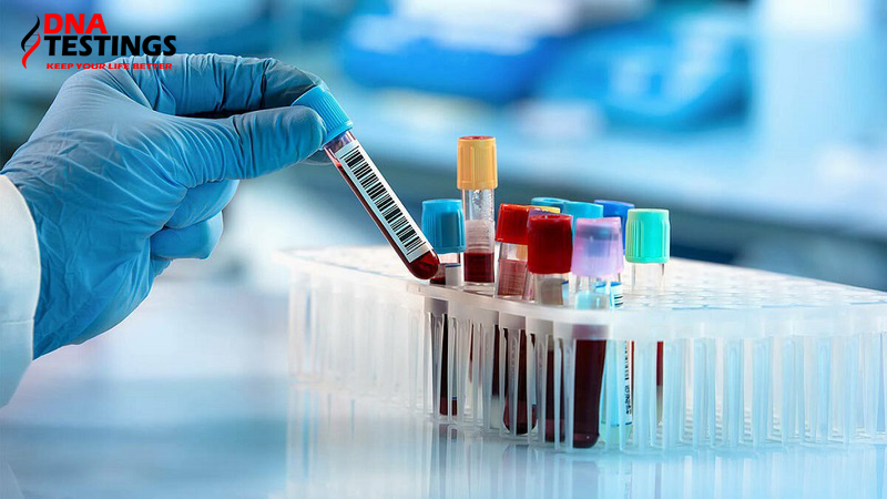 xét nghiệm HCV-RNA viêm gan C