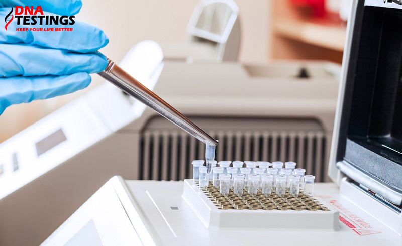 Xét nghiệm PCR là gì? Ưu, nhược điểm của xét nghiệm PCR
