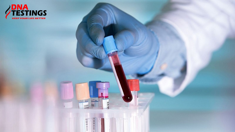Điện di huyết sắc tố (Hemoglobin-Hb) trong sàng lọc Thalassemia