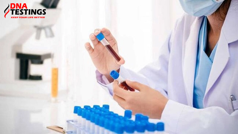 chi phí xét nghiệm double test