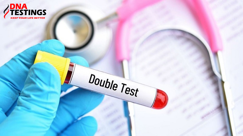 Xét nghiệm Double test là gì? Chi phí và bao lâu thì có kết quả